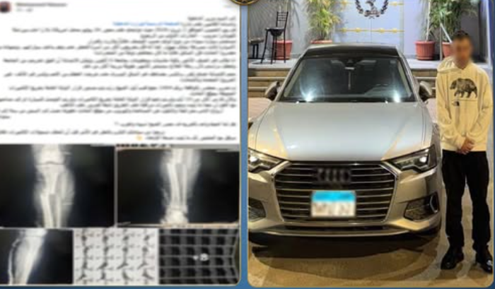 ضبط سائق صدم شخصًا وفر هاربًا في الشيخ زايد